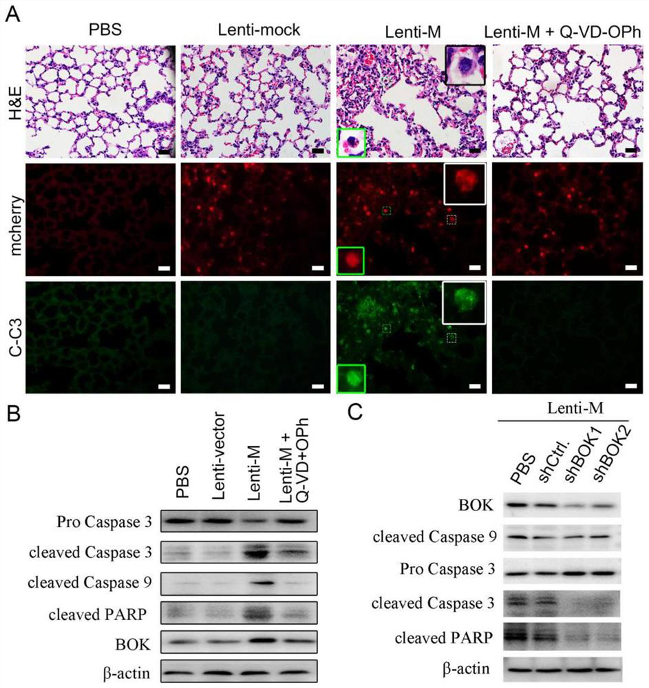 Application of intervening BOK in preparation of medicine for treating COVID-19