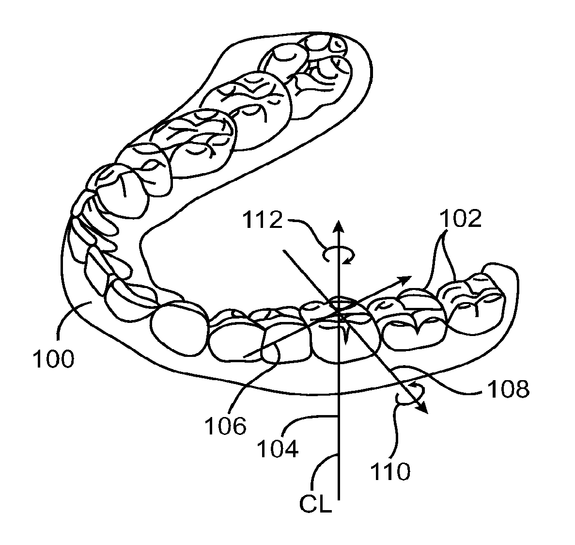 Computer automated development of an orthodontic treatment plan and appliance