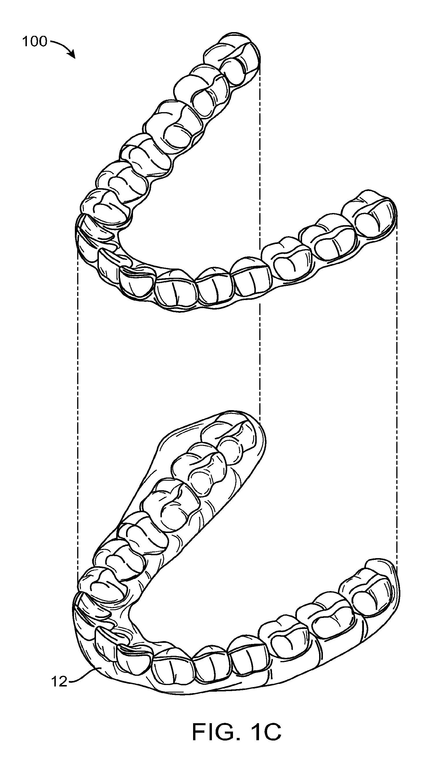 Computer automated development of an orthodontic treatment plan and appliance