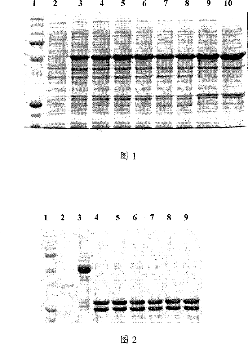 Antihuman SCGN monoclone antibody, preparation, application and hybrid tumor cell strain