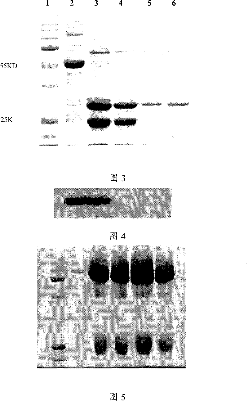 Antihuman SCGN monoclone antibody, preparation, application and hybrid tumor cell strain