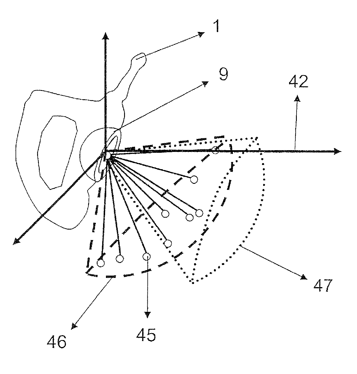 Joint placement methods and apparatuses