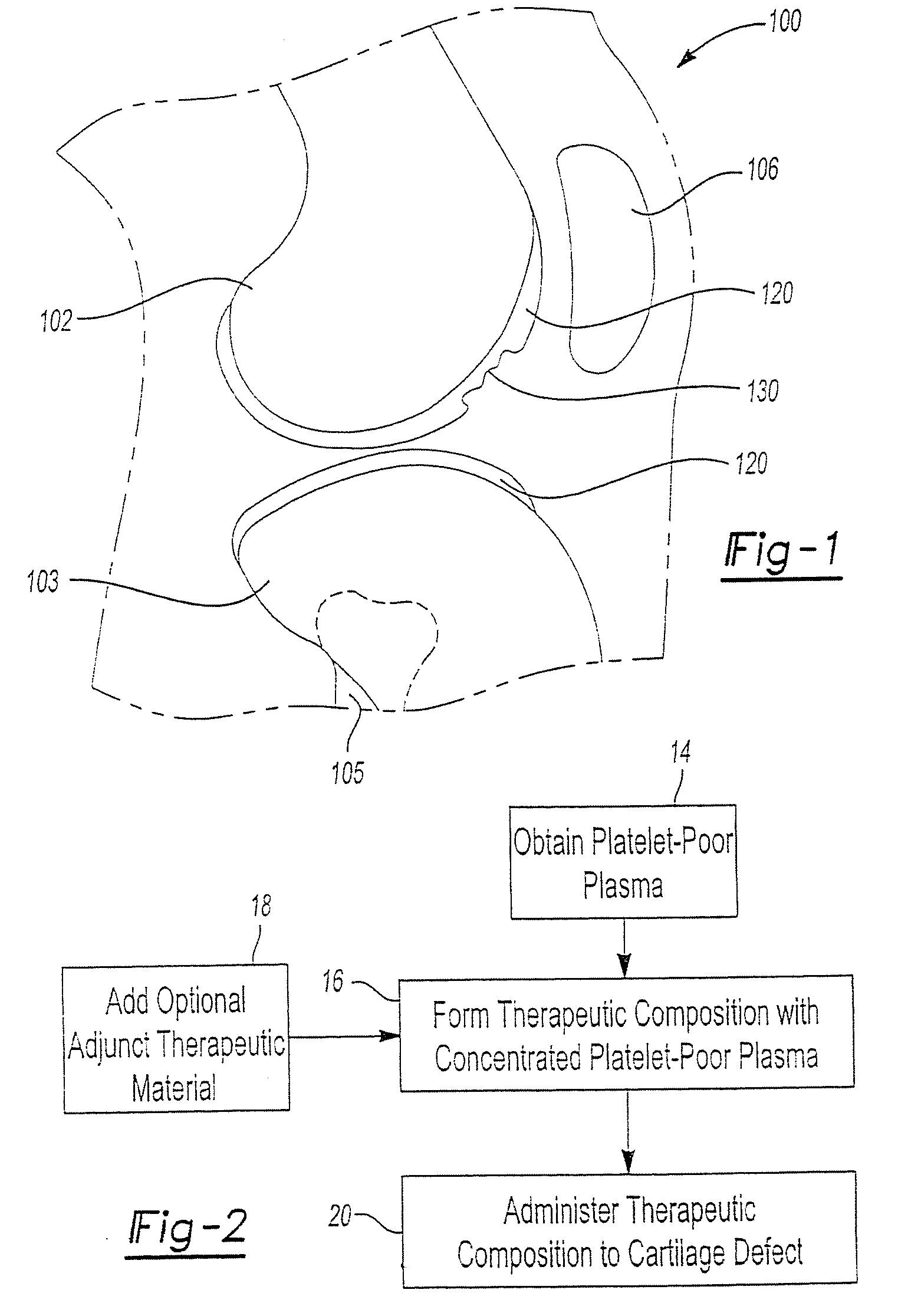 Method and device for repair of cartilage defects