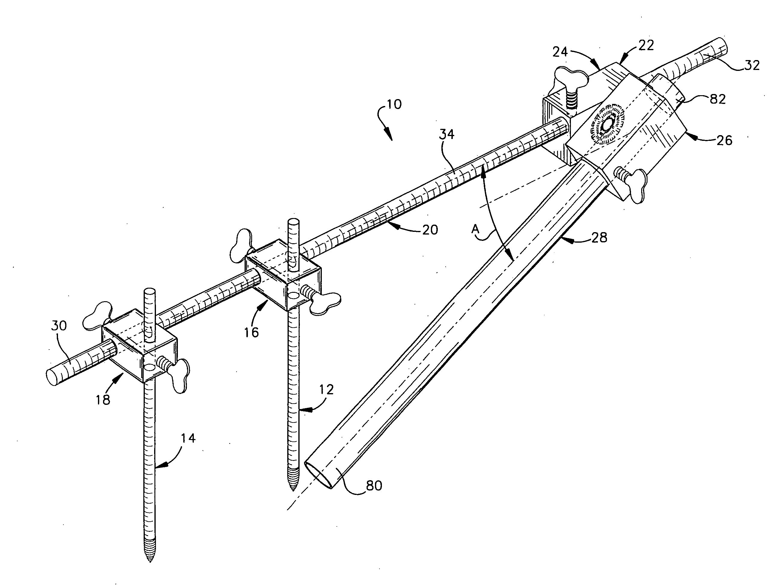 Minimally invasive method and apparatus for placing facet screws and fusing adjacent vertebrae