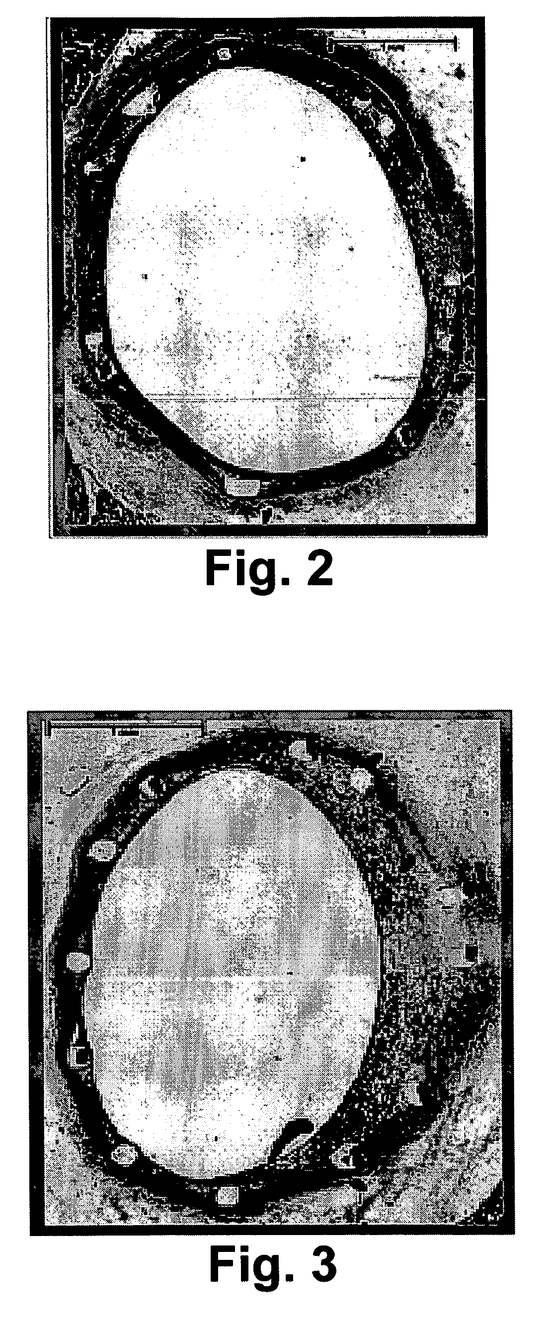 Halofuginone delivering vascular medical devices