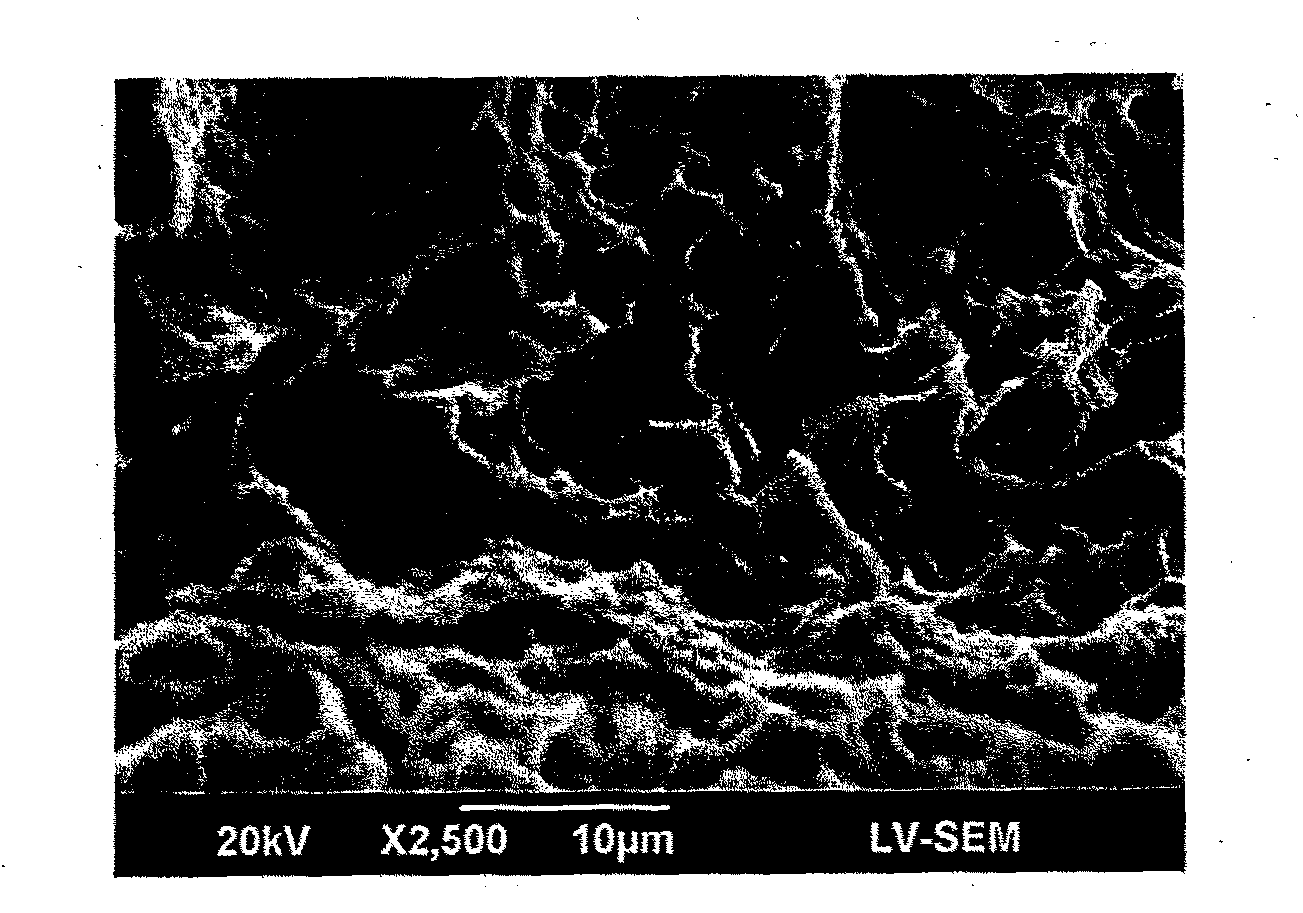 Metal implant and surface processing method thereof