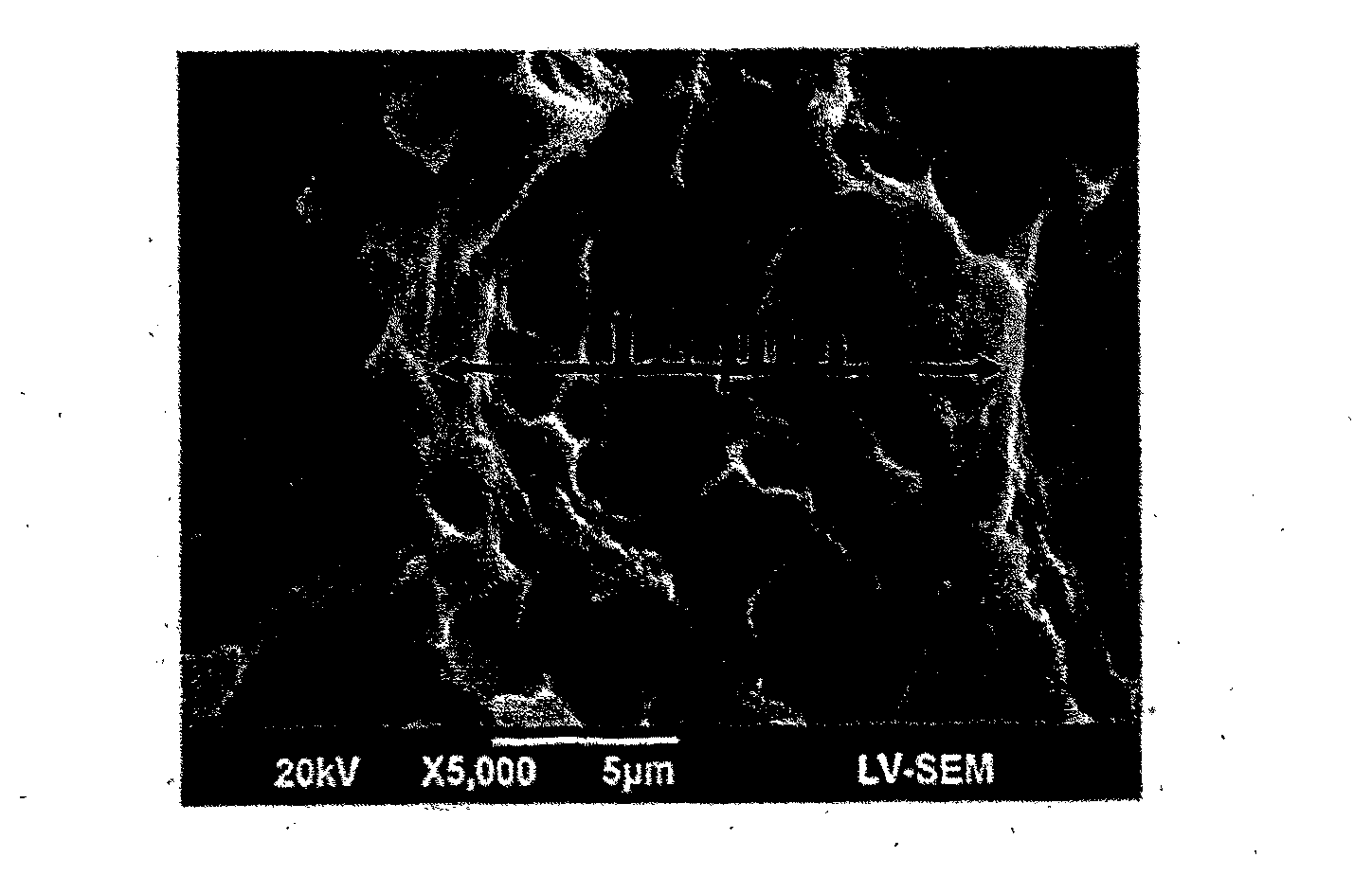 Metal implant and surface processing method thereof