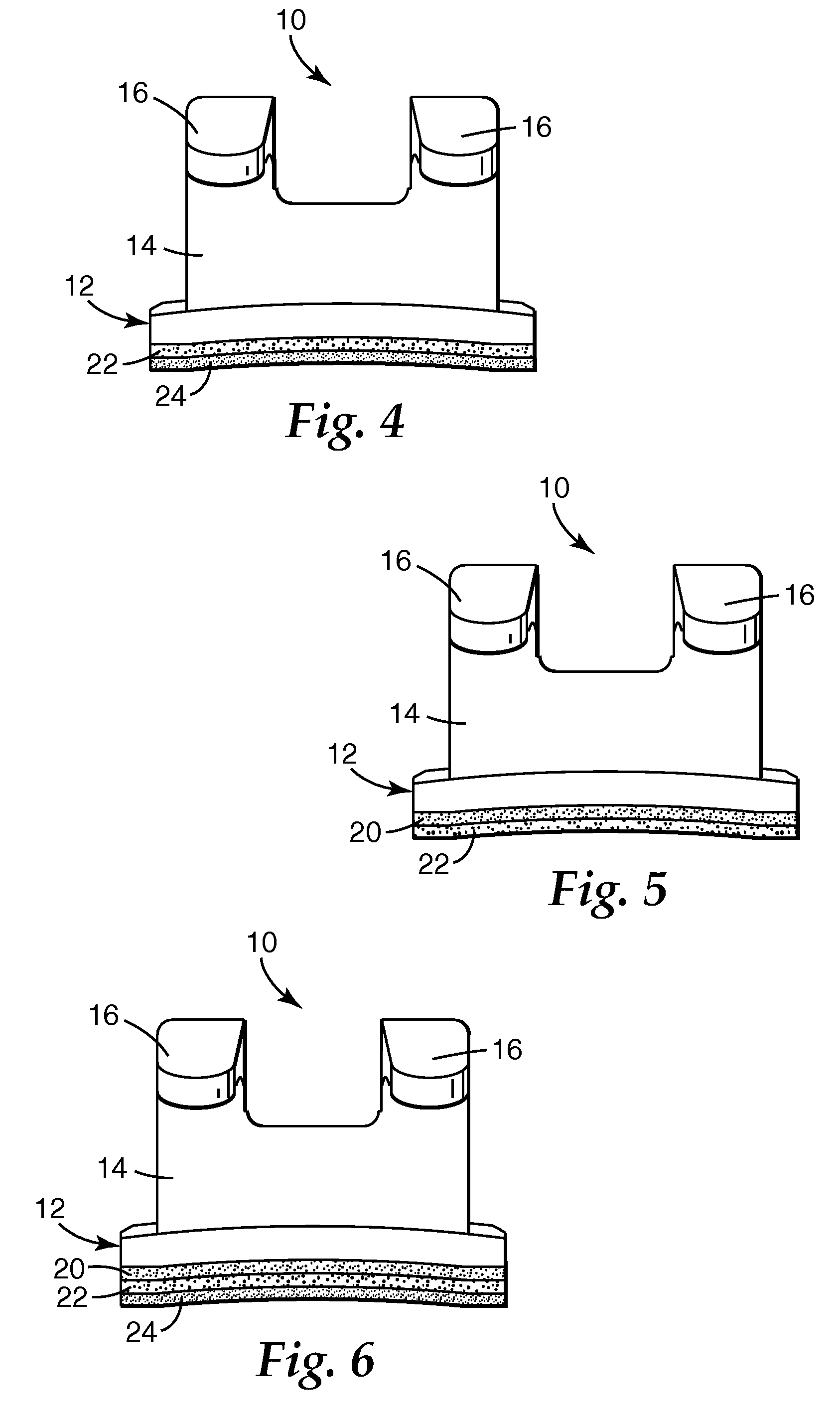 Dental compositions including a thermally labile component, and the use thereof