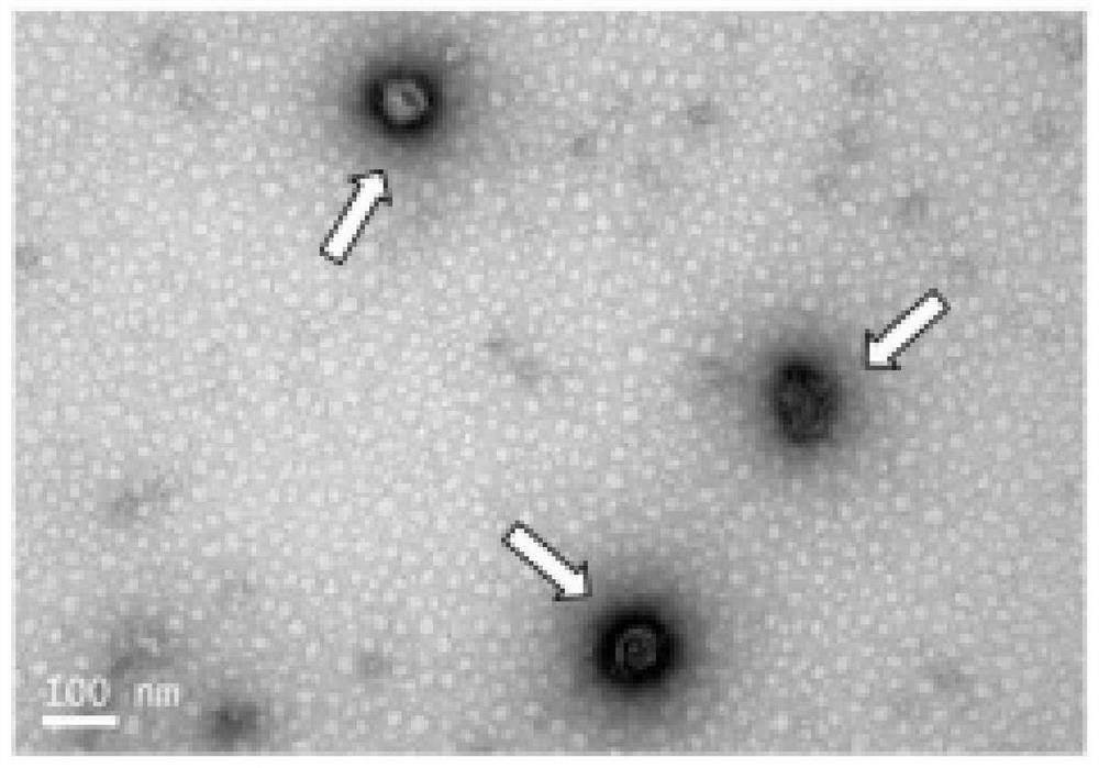 Application of mesenchymal stem cell exosome in preparation of drugs for preventing or treating type 1 diabetes and related diseases thereof