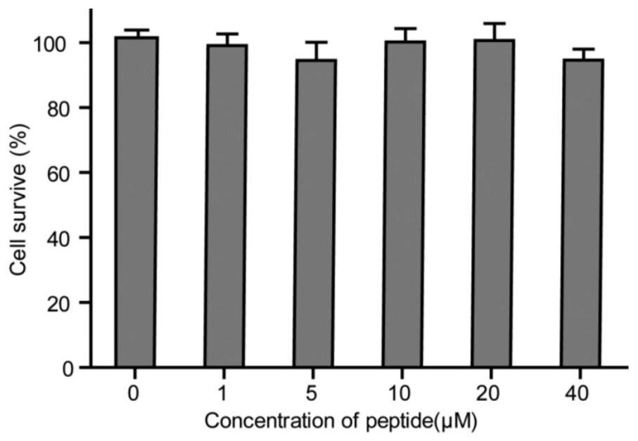 Nanoparticle targeting breast cancer cell and lymph node metastasis focus, preparation method and application