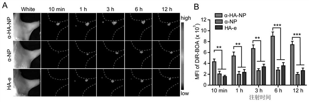 Nanoparticle targeting breast cancer cell and lymph node metastasis focus, preparation method and application