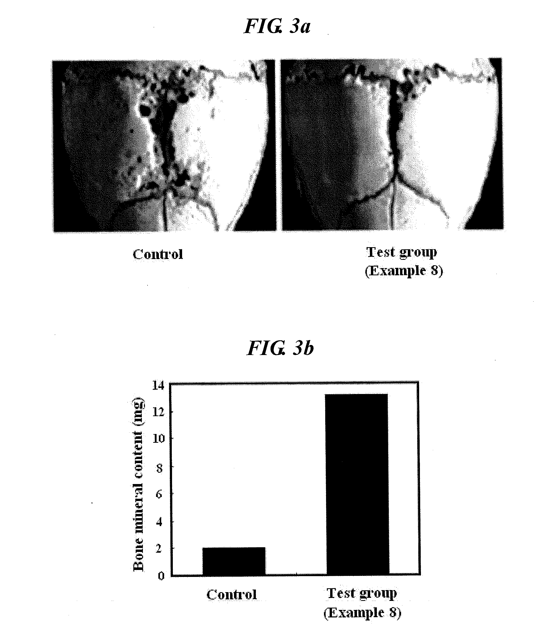 Isoindolinone derivatives, preparation method thereof and a pharmaceutical composition comprising same