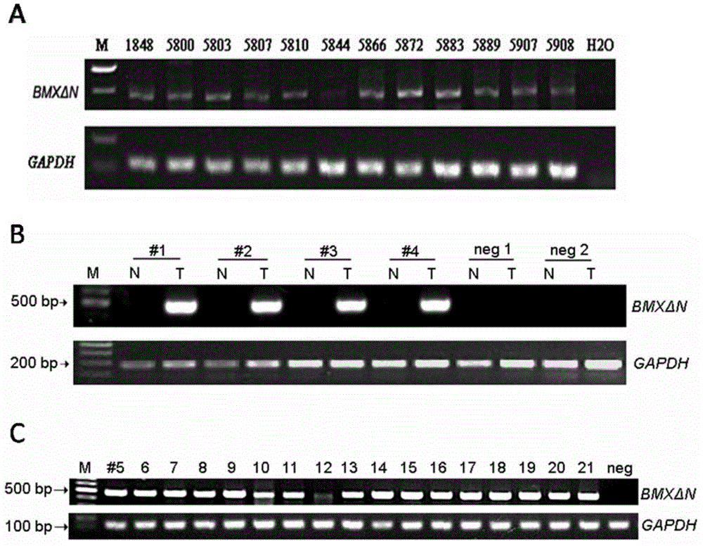 A BMX spliceosome and applications thereof in lung cancer drug resistance