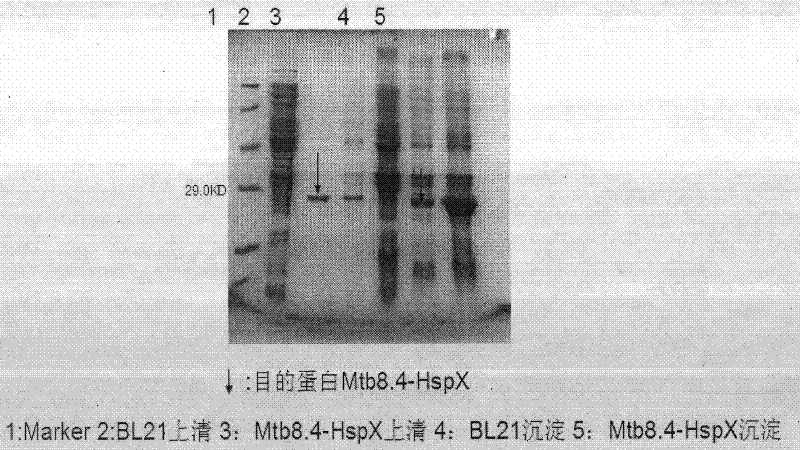 Tubercle bacillus fusion protein Mtb8.4-HspX, and preparation method and application thereof