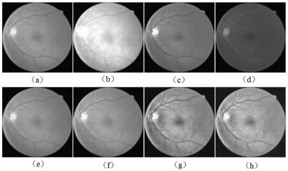 Eye fundus retina image segmentation method based on deep convolutional neural network