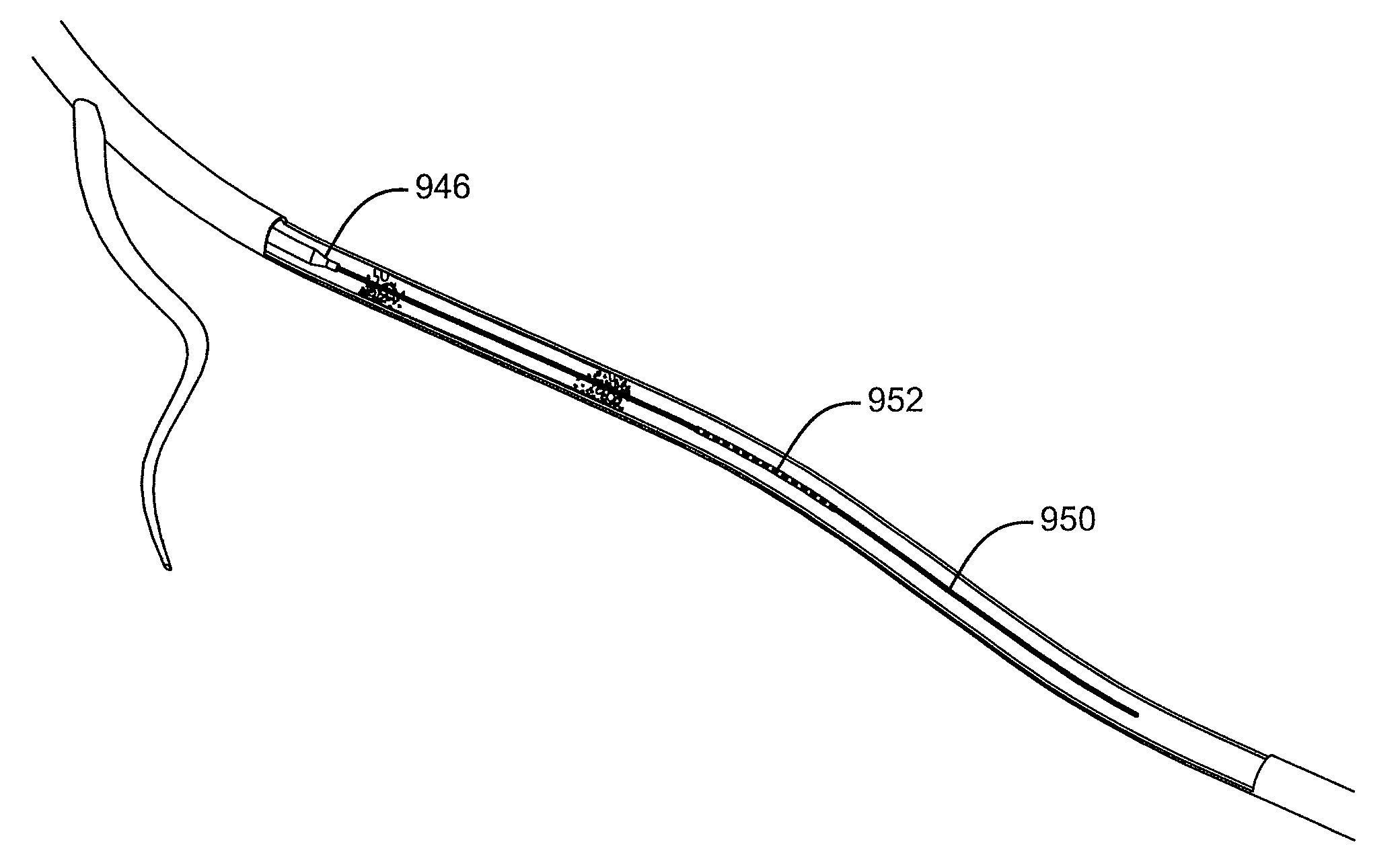 Implant delivery technologies