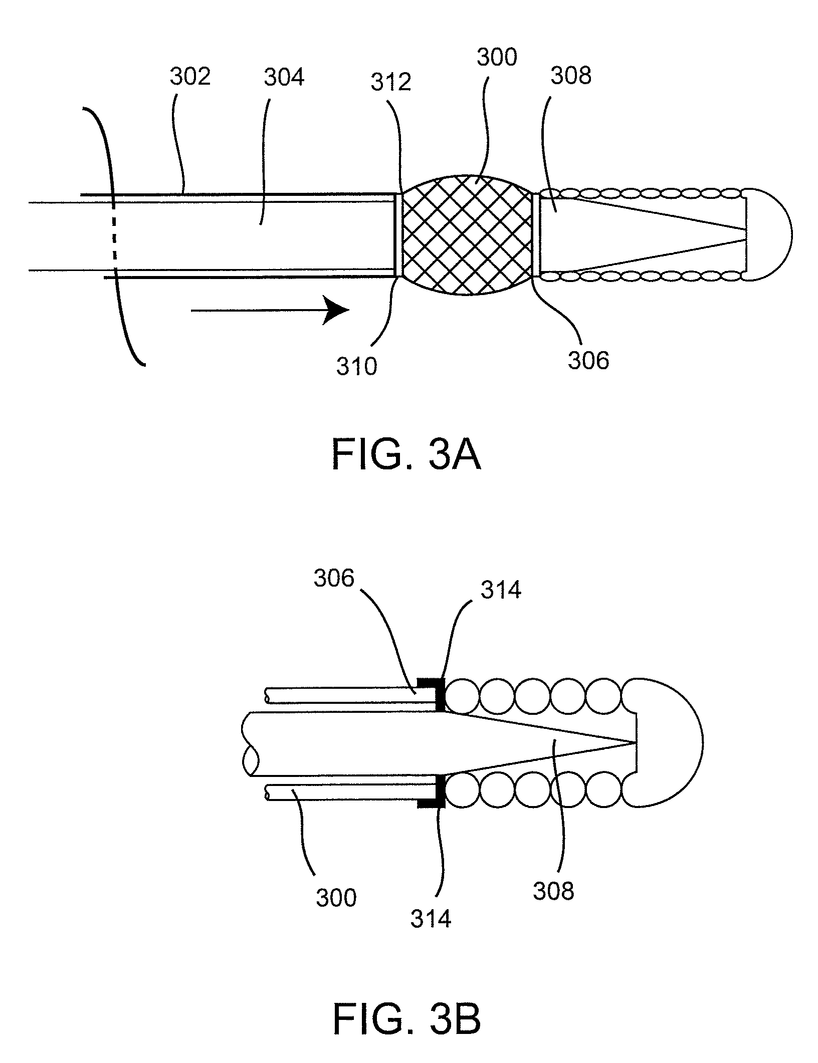 Implant delivery technologies