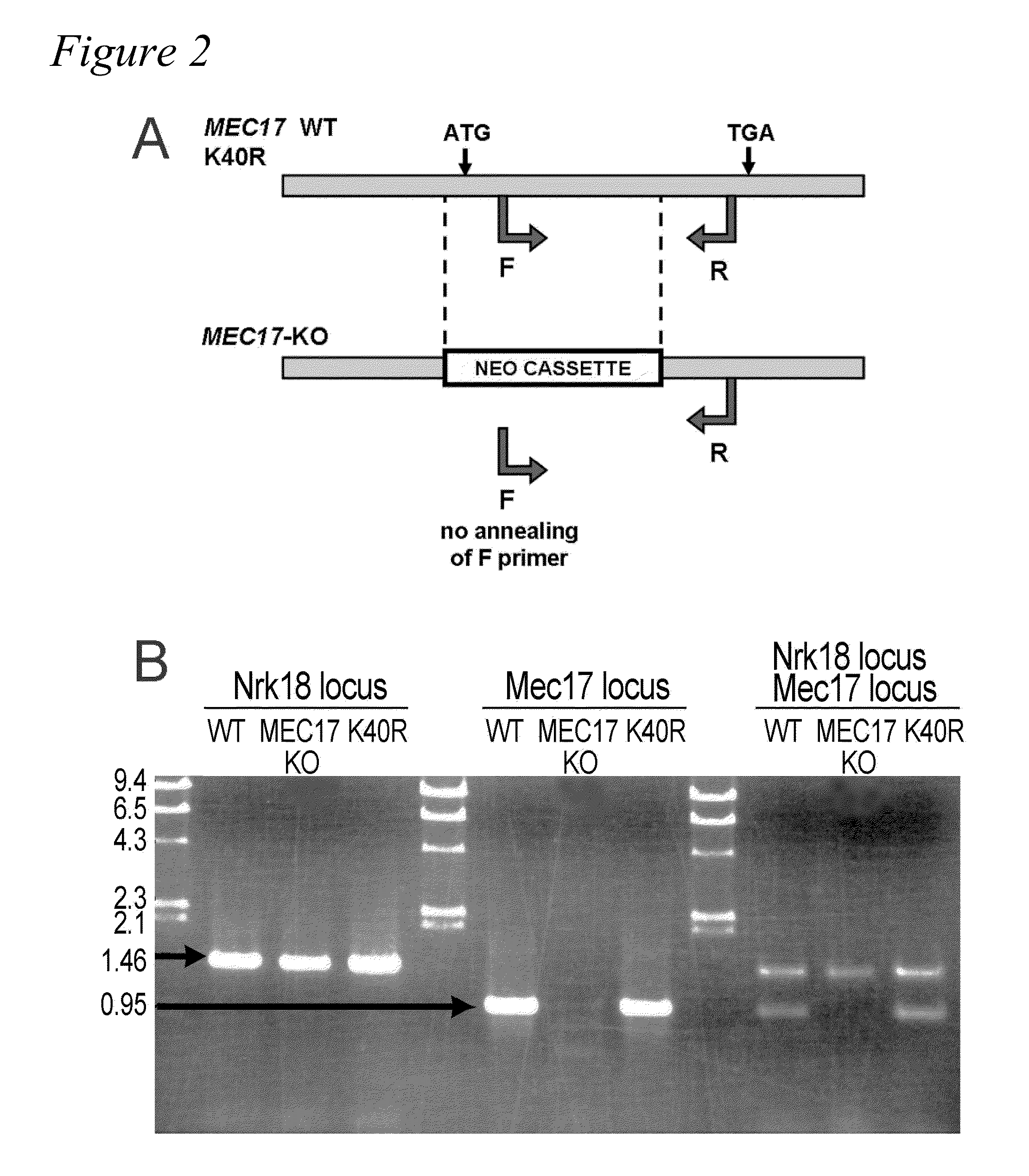 Alpha-tubulin acetyltransferase