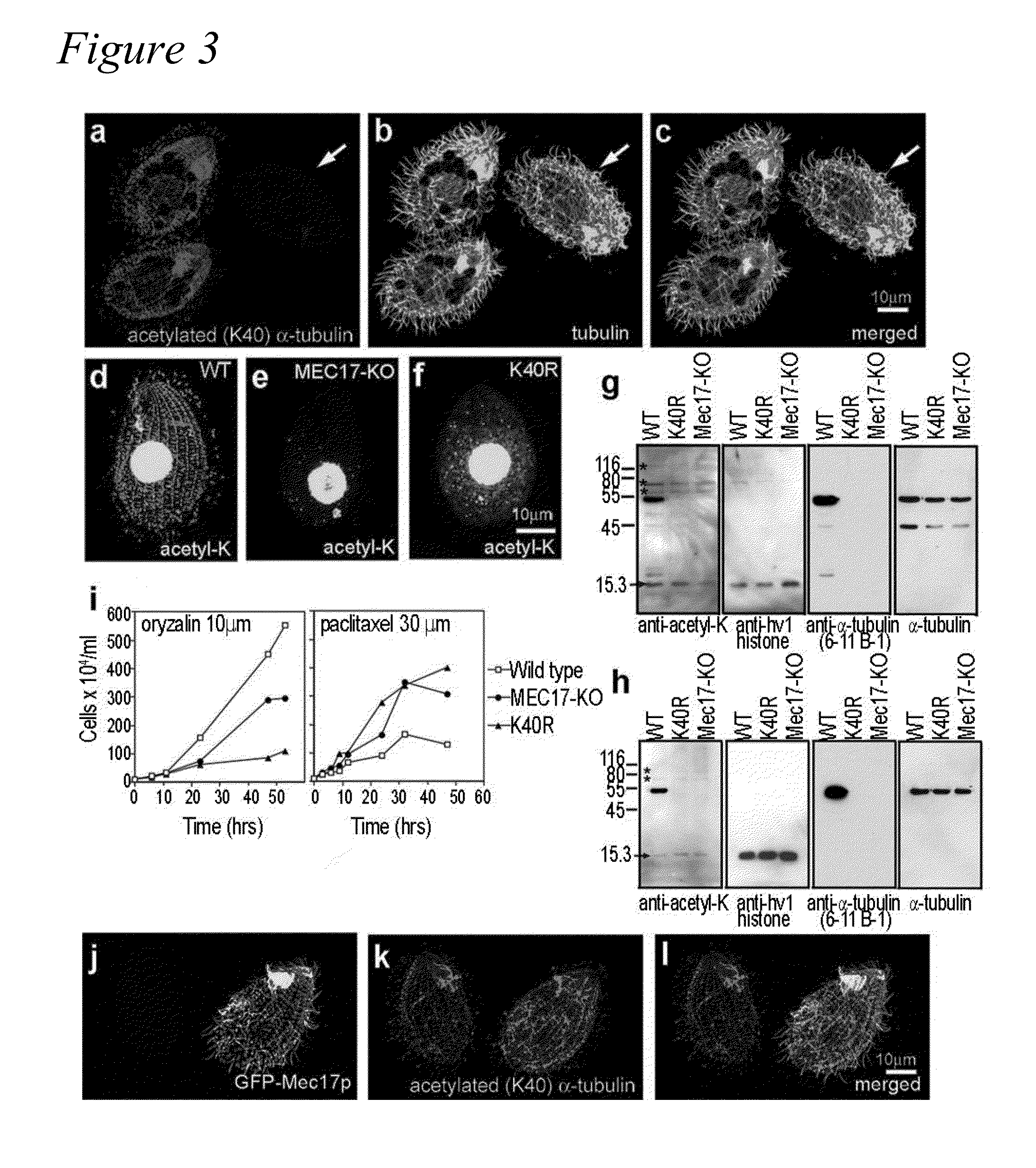 Alpha-tubulin acetyltransferase