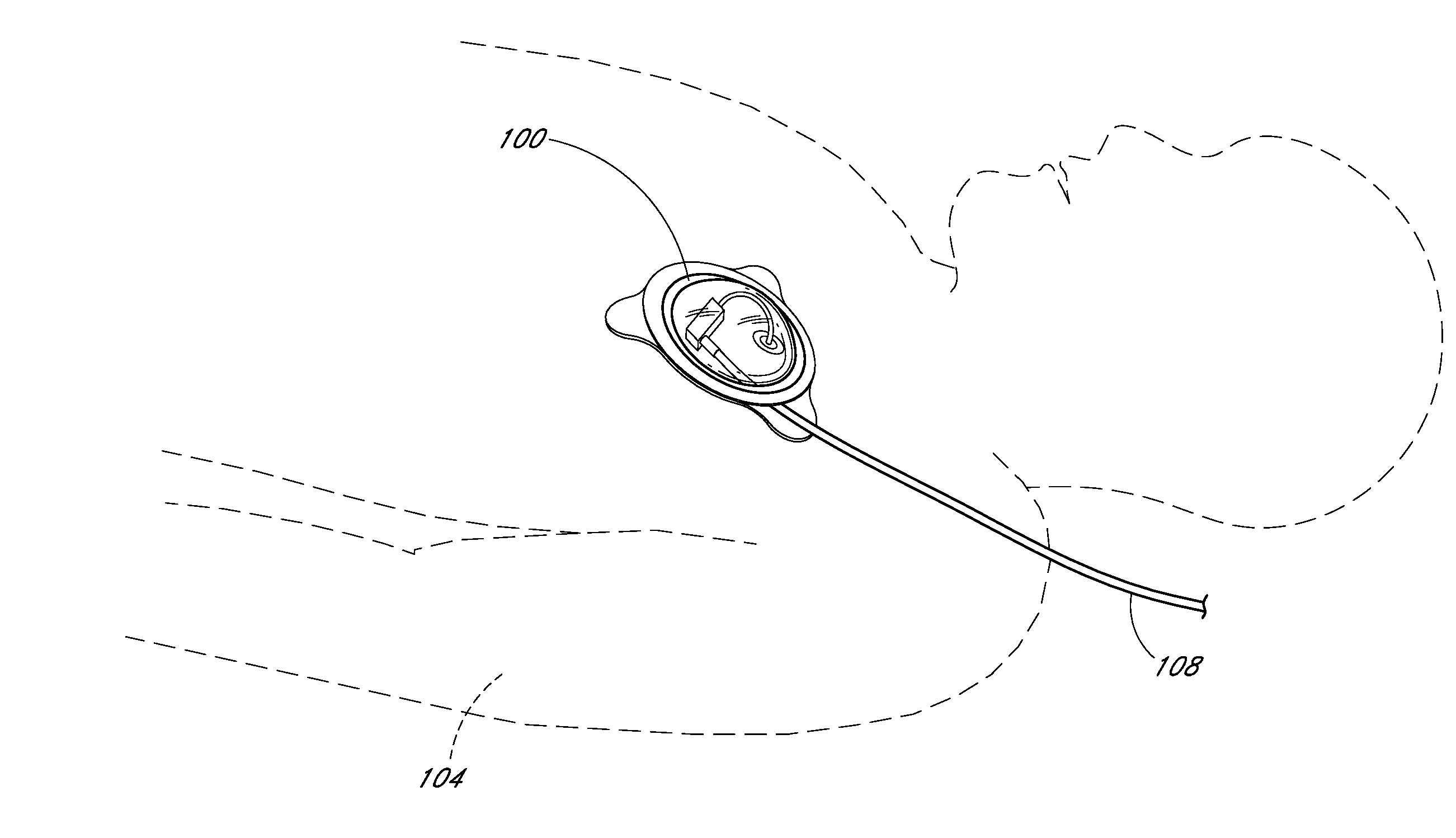 Patient status sensor