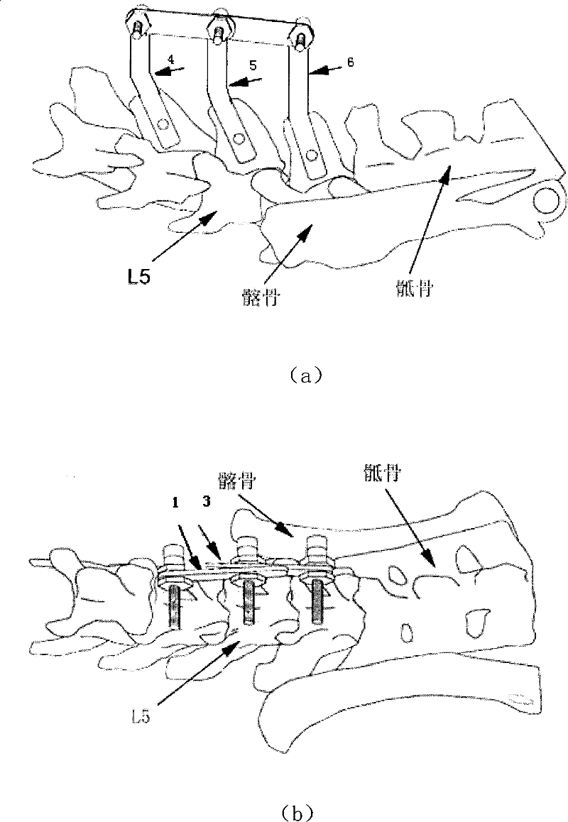 External connection fixing device for manufacturing rat spine subluxation animal model