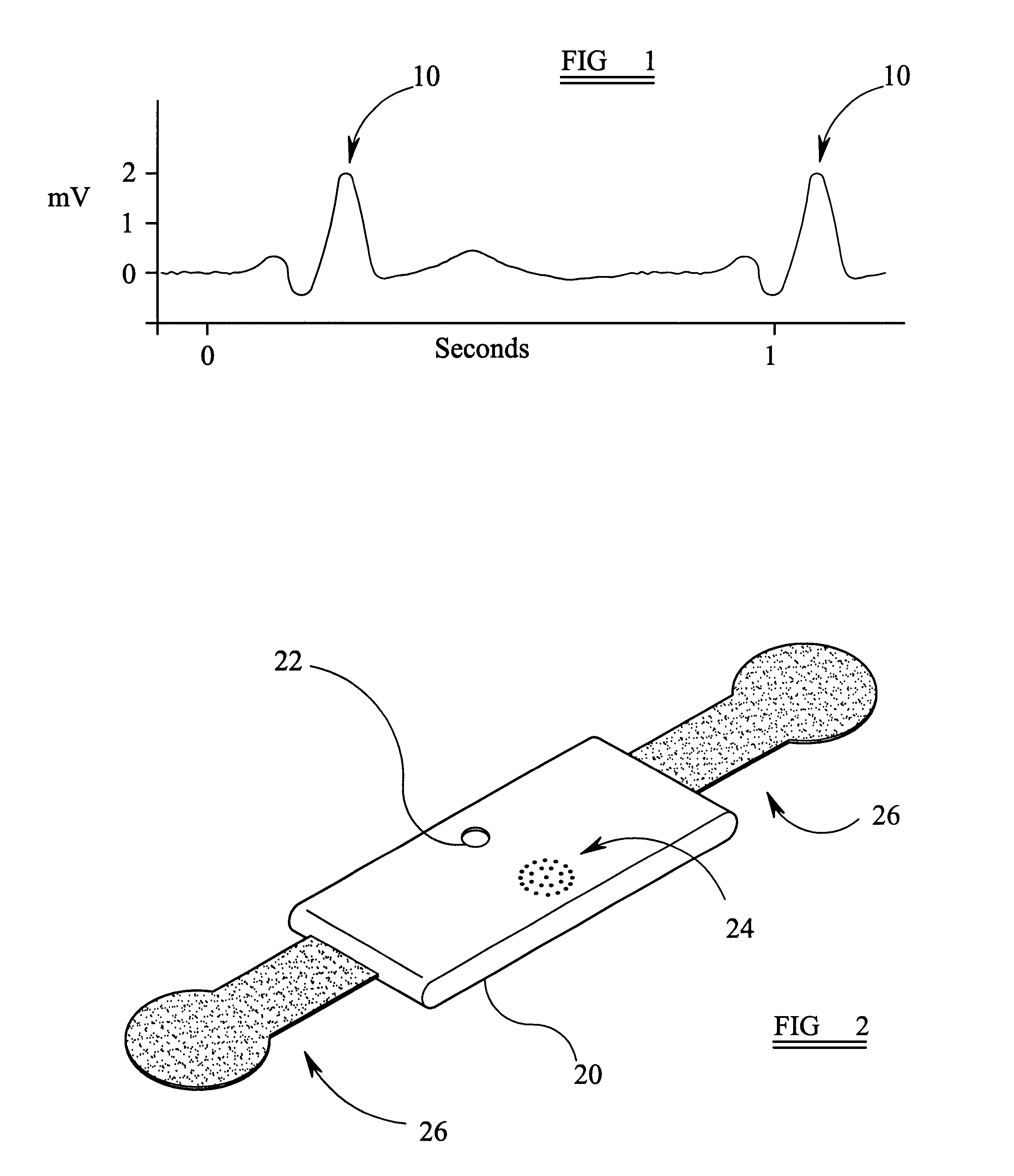 Heart activity detection apparatus