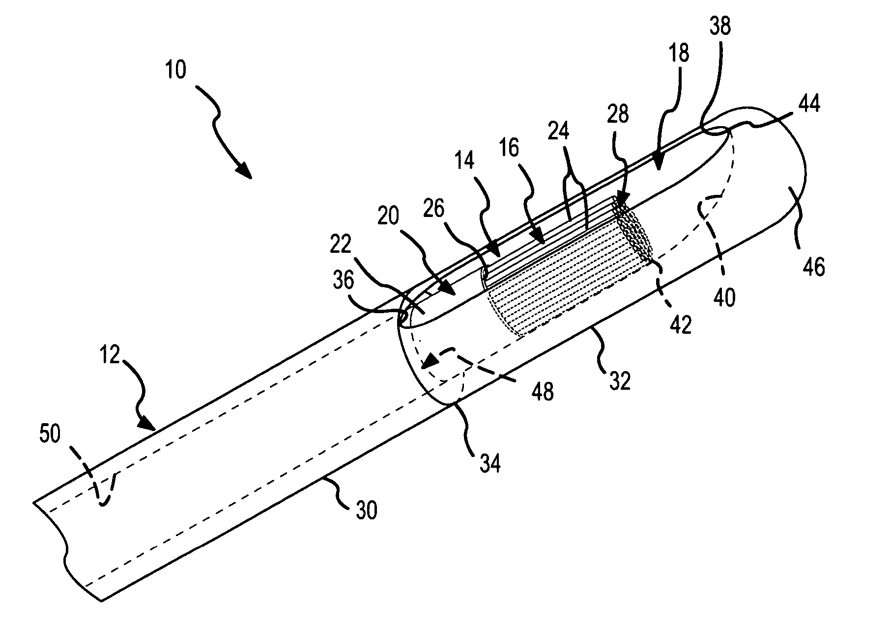 Side-port sheath for catheter placement and translation