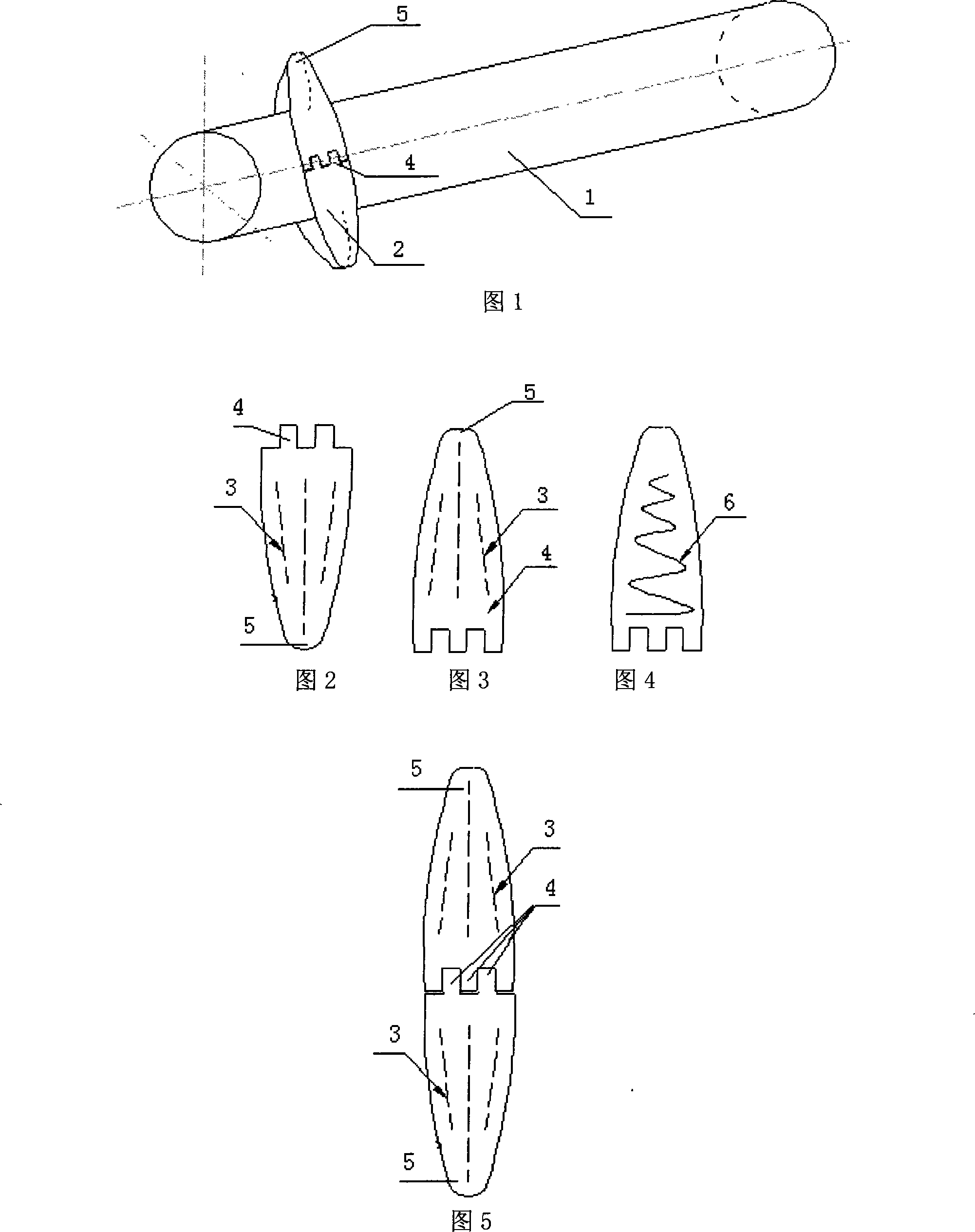 Submarine pipeline vortex-induced vibration inhibiting method