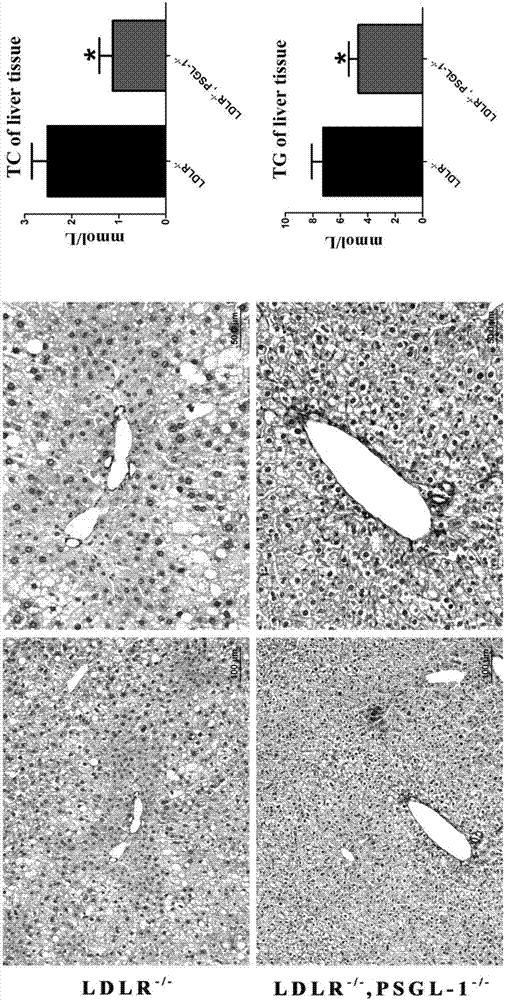 Construction and application of inflammation molecule (PSGL-1) missing abnormal lipid metabolism model