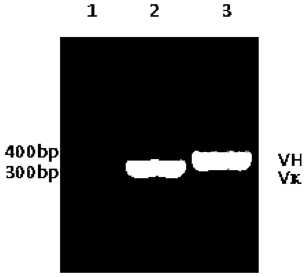 T-lymphocytes modified by trop2 chimeric antigen receptor and its application