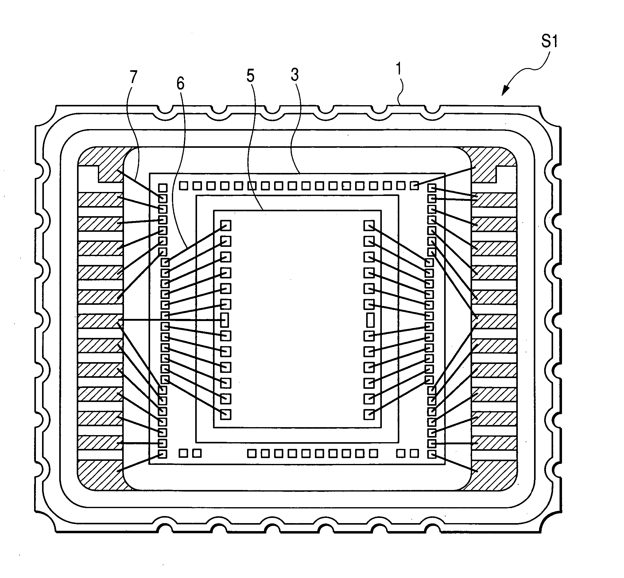 Vibration-type angular rate sensor