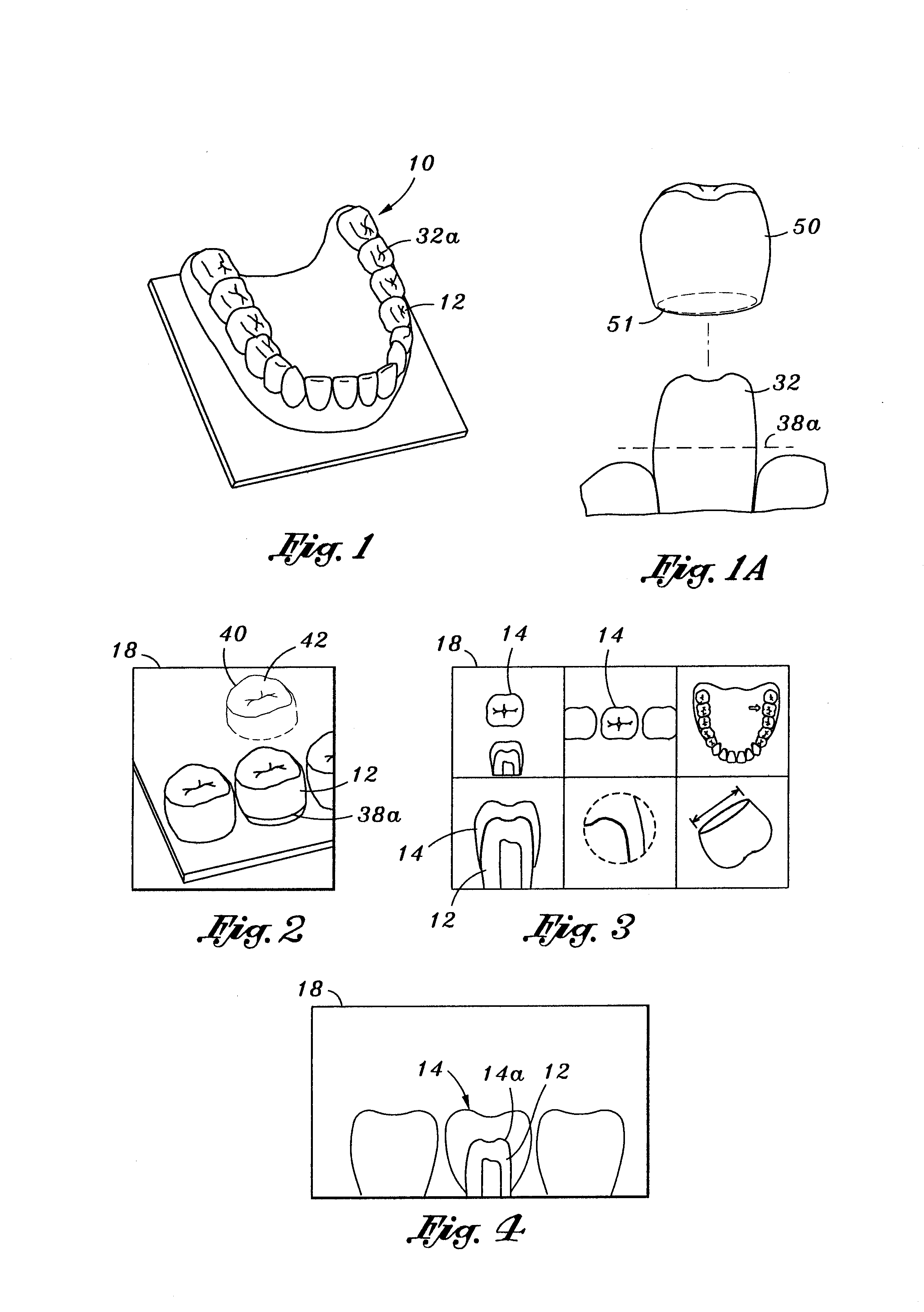 Dental prosthesis manufacturing process, dental prosthesis pattern @$amp; dental prosthesis made thereby