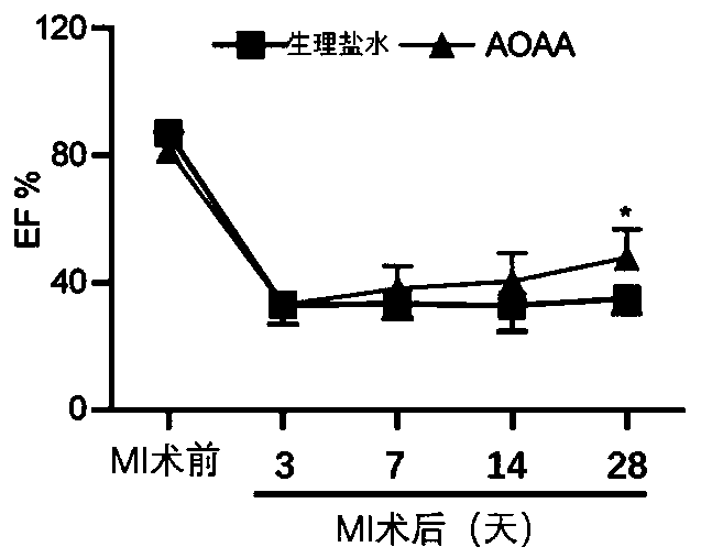 Application of aminooxyacetic acid (AOAA) in preparation of drug for preventing or treating myocardial infarction