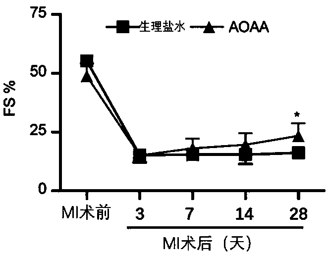 Application of aminooxyacetic acid (AOAA) in preparation of drug for preventing or treating myocardial infarction
