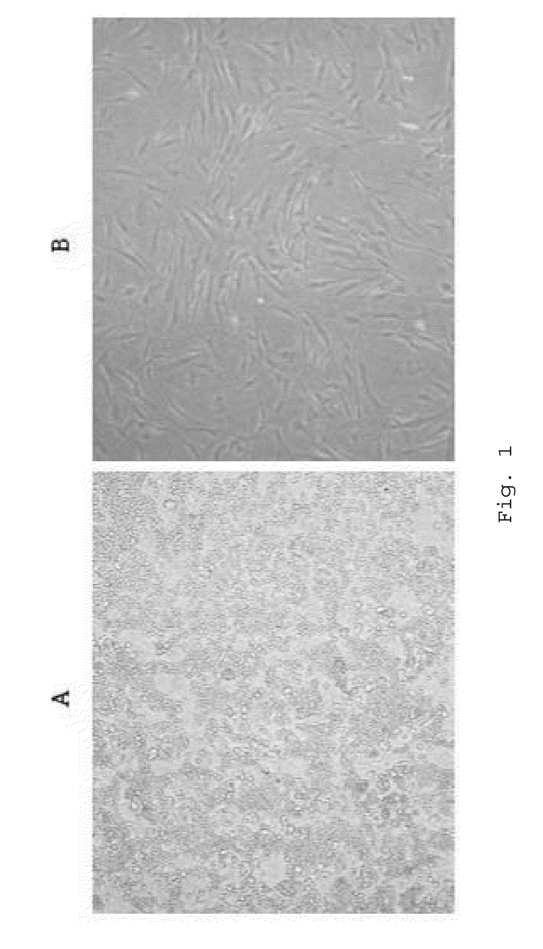 Culture medium of adipose-derived stem cell, method for preparing the same, and composition including the same for promoting hair growth