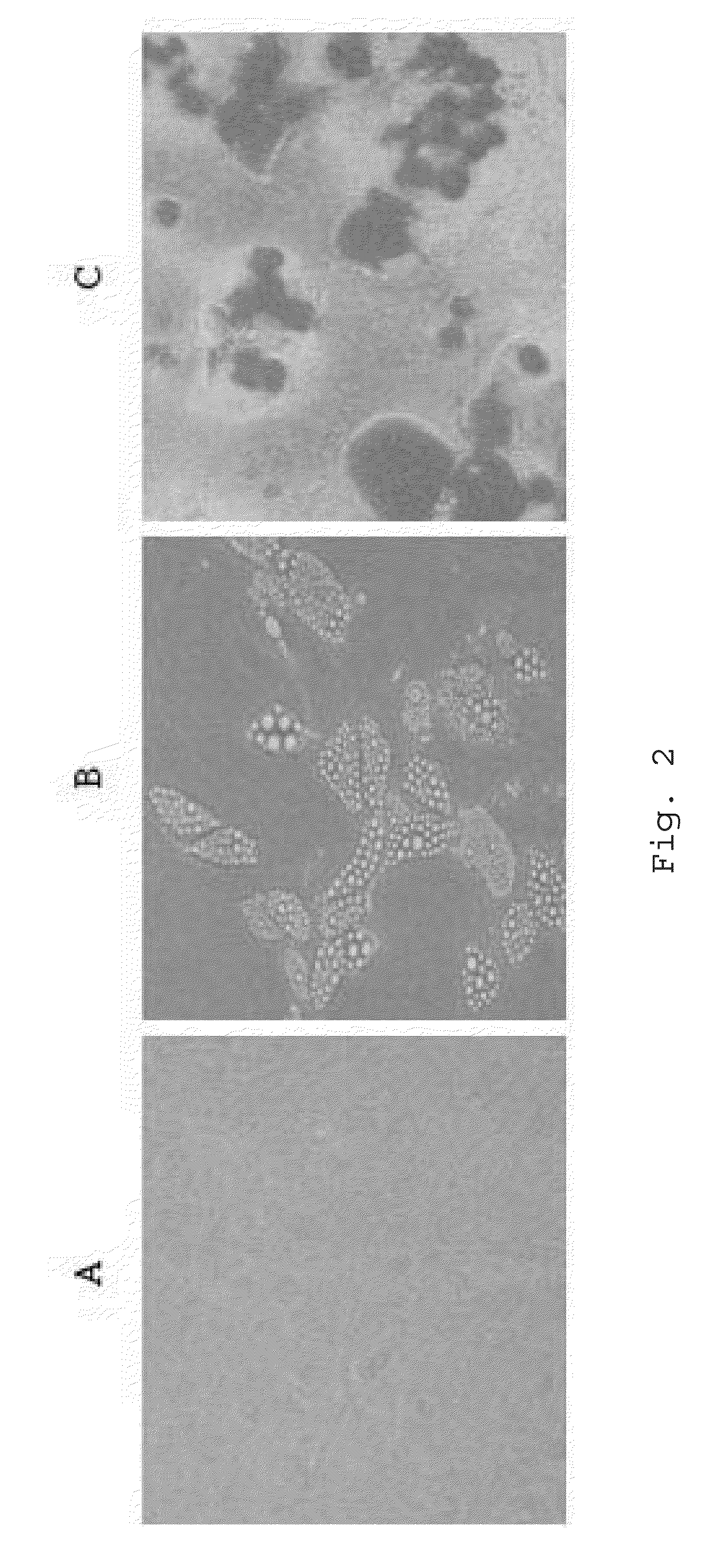 Culture medium of adipose-derived stem cell, method for preparing the same, and composition including the same for promoting hair growth