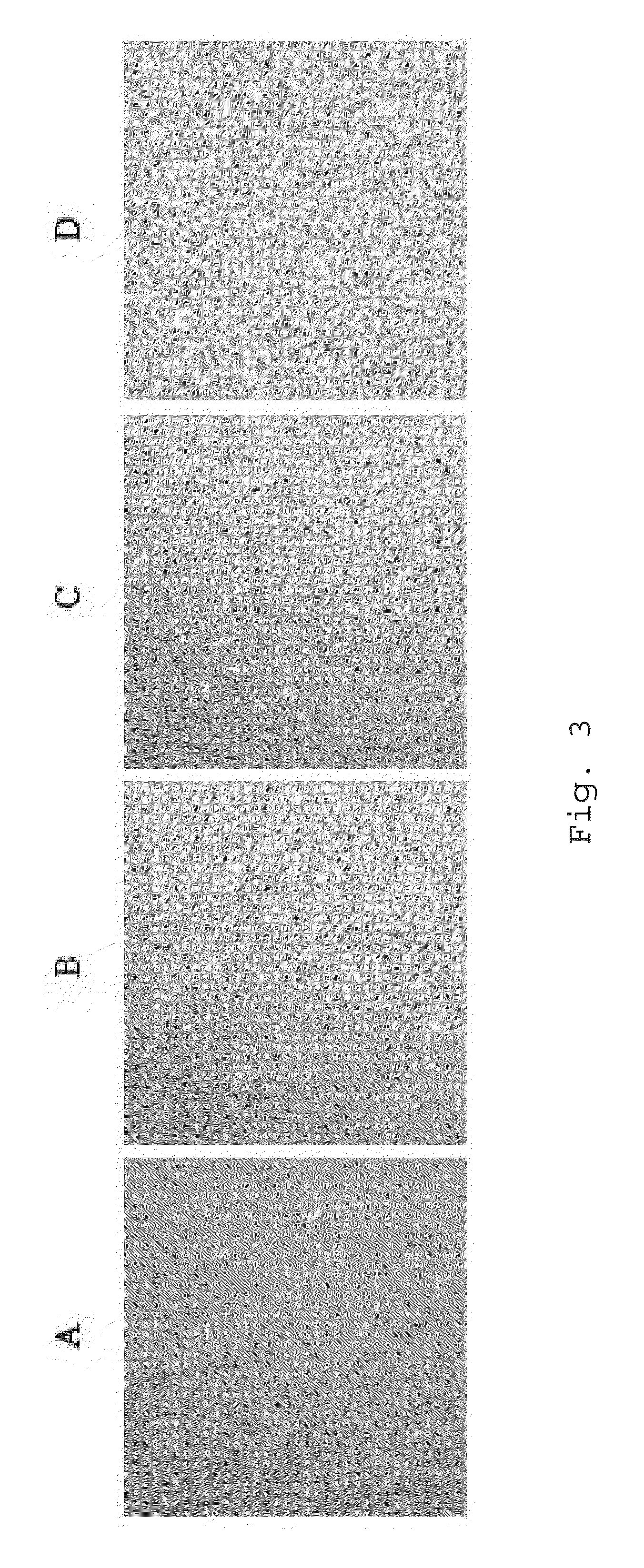 Culture medium of adipose-derived stem cell, method for preparing the same, and composition including the same for promoting hair growth