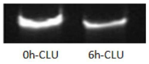 A kind of complete set of siRNA for suppressing clusterin gene expression and application thereof