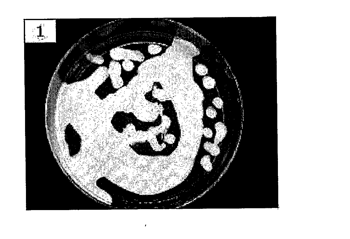 Method For Preparing Radioactive Film