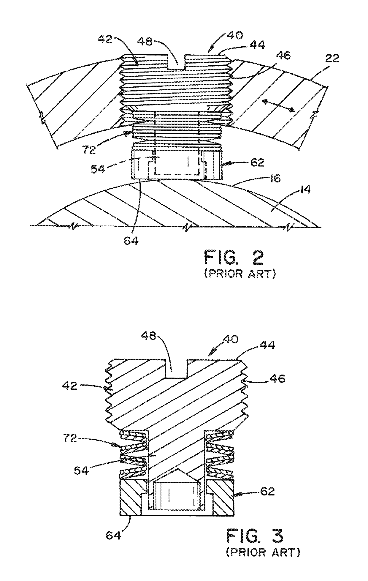 Brake screw for surgical lighting systems