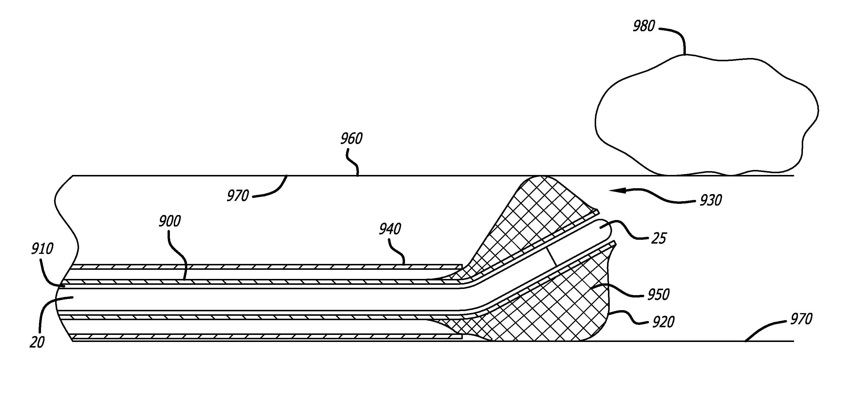 Directional anchoring mechanism, method and applications thereof