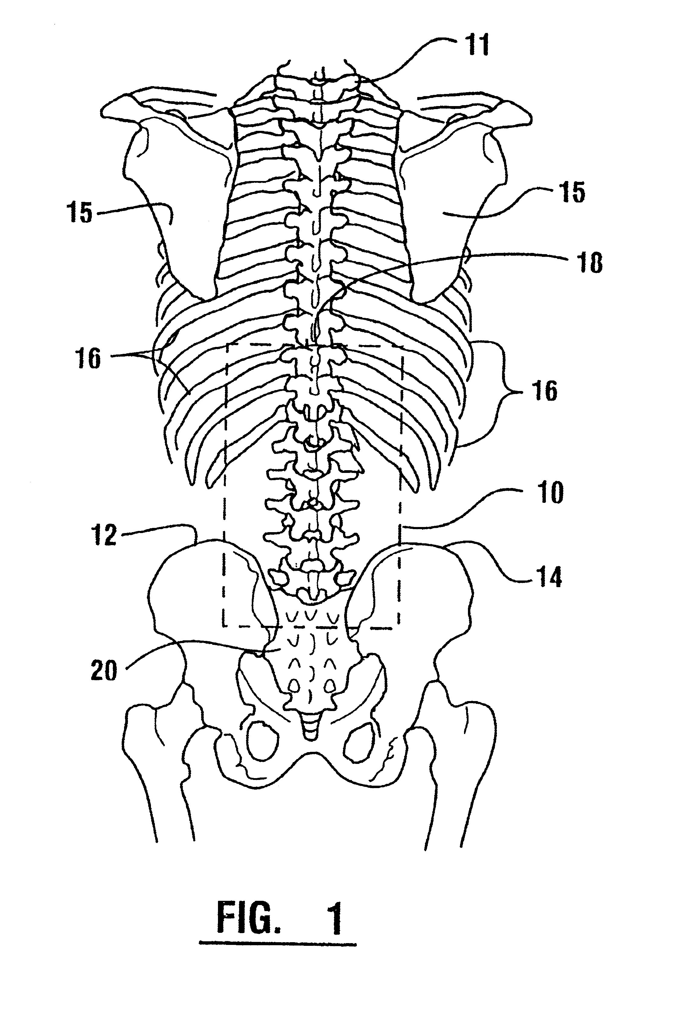 EMG electrode apparatus and positioning system