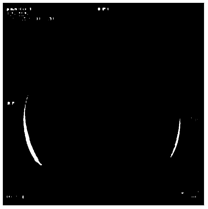 Embolism material composition as well as preparation method and use thereof