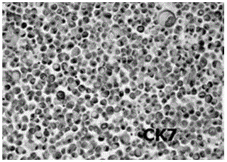 Cell wax block preparation kit and preparation method thereof