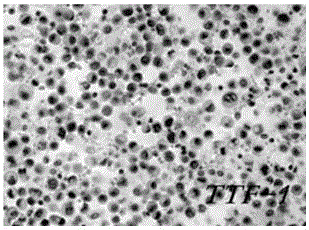 Cell wax block preparation kit and preparation method thereof