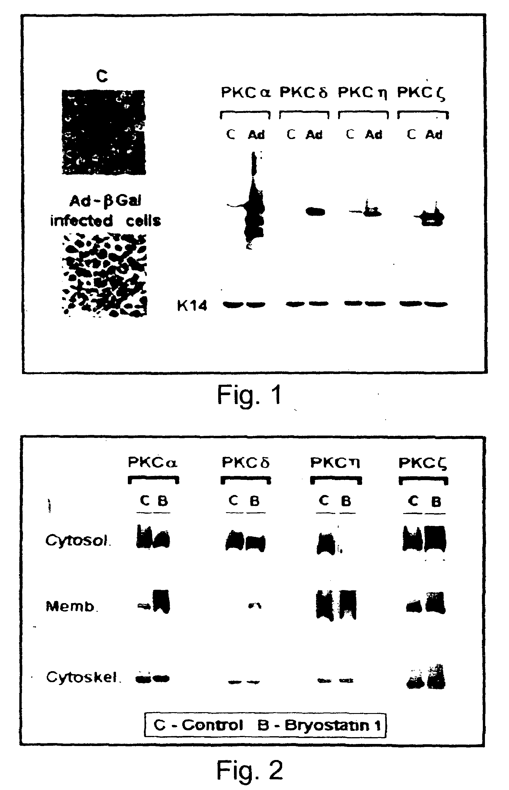 Methods and pharmaceutical compositions for healing wounds