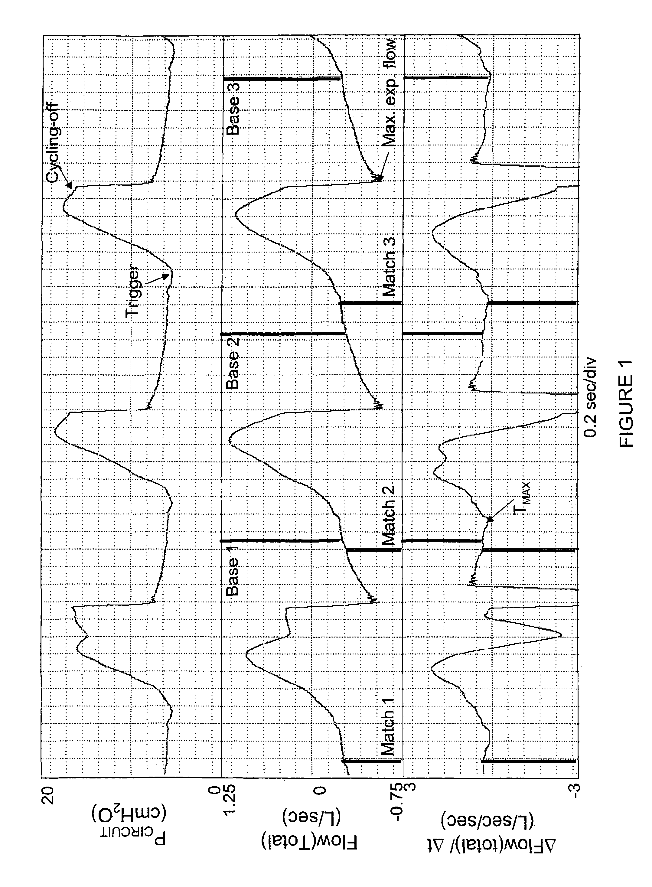 Method for estimating leaks from ventilator circuits