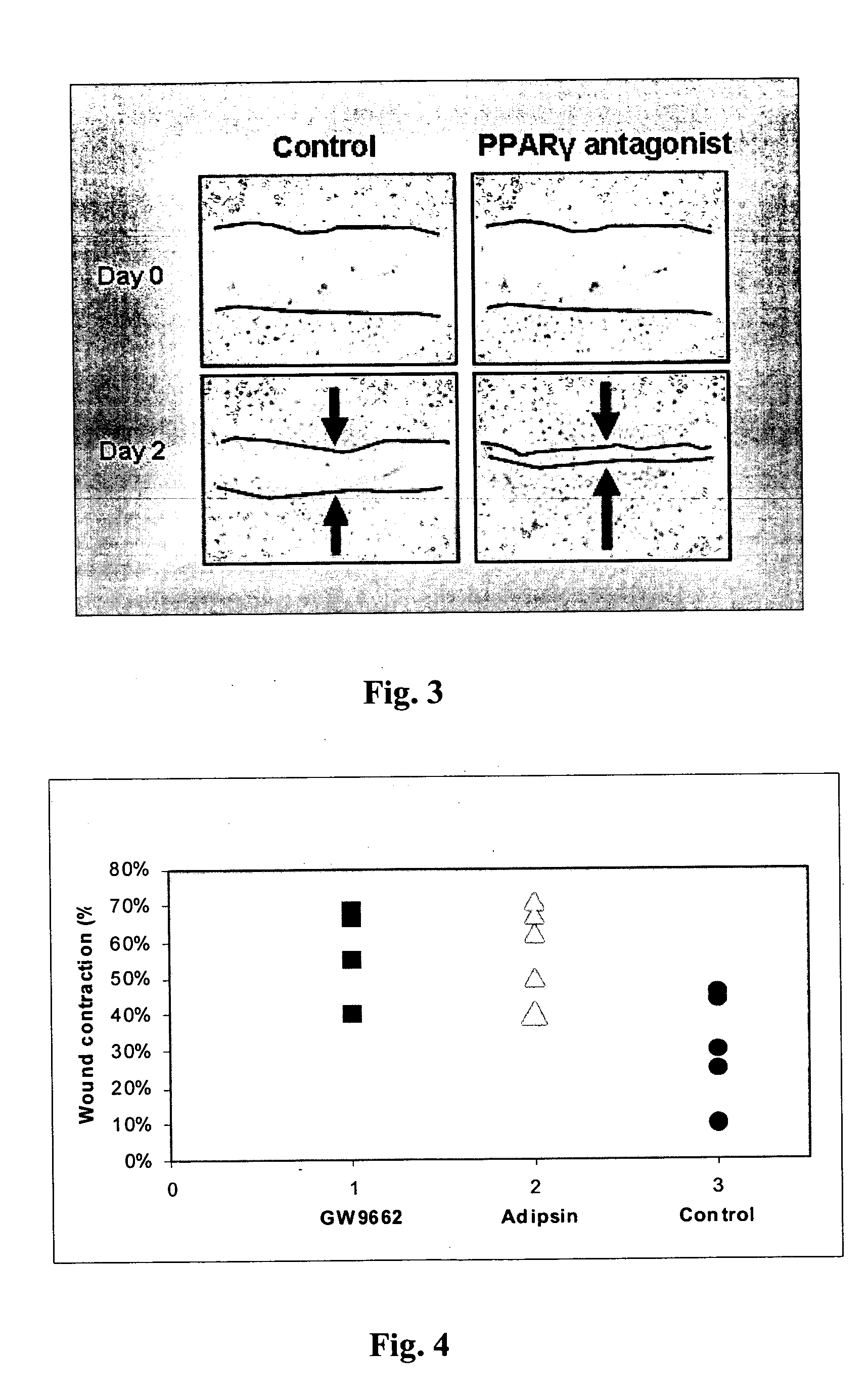 Methods for accelerating wound healing by administration of adipokines