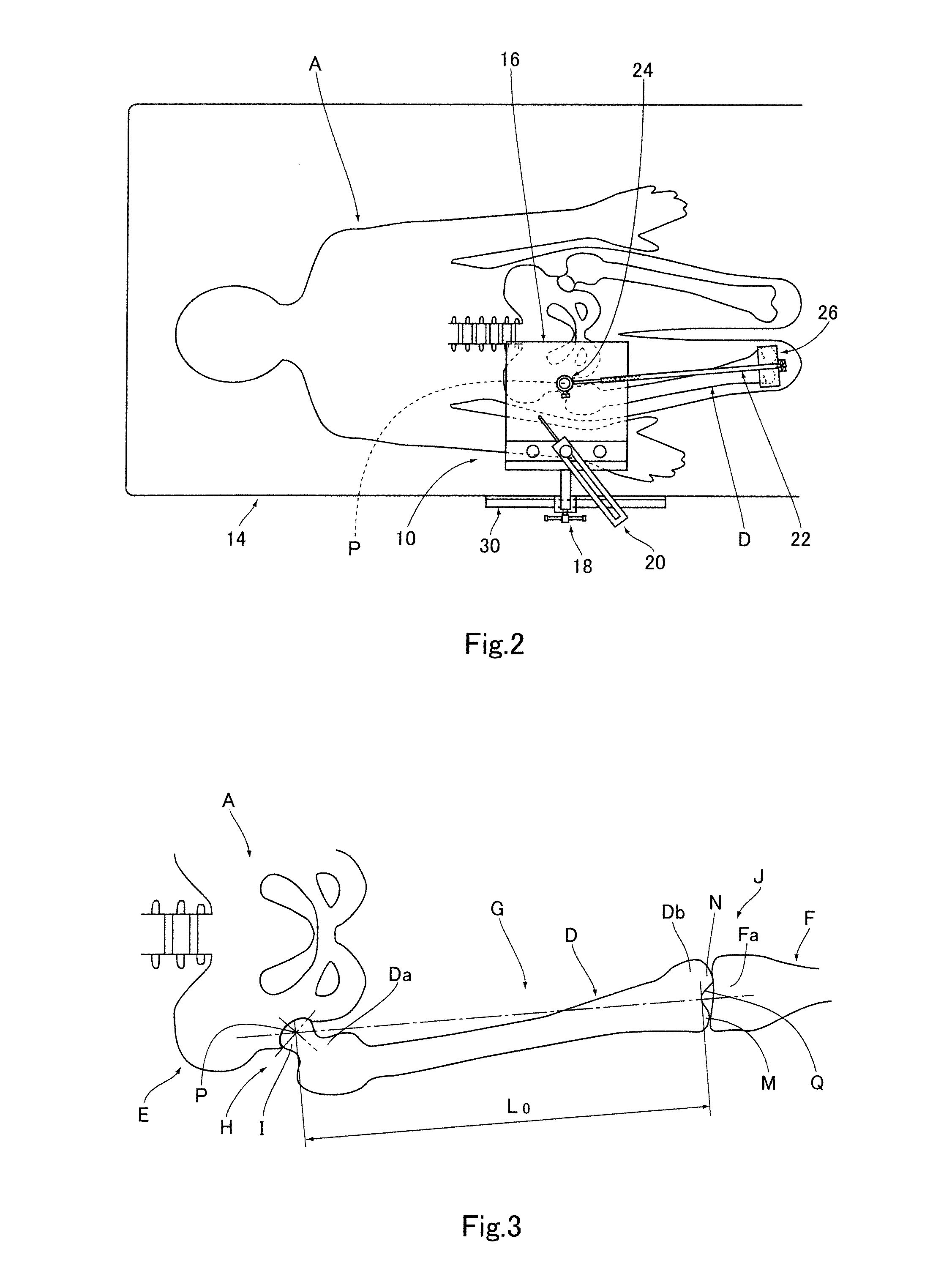 Apparatus for Identifying Femoral Head Center