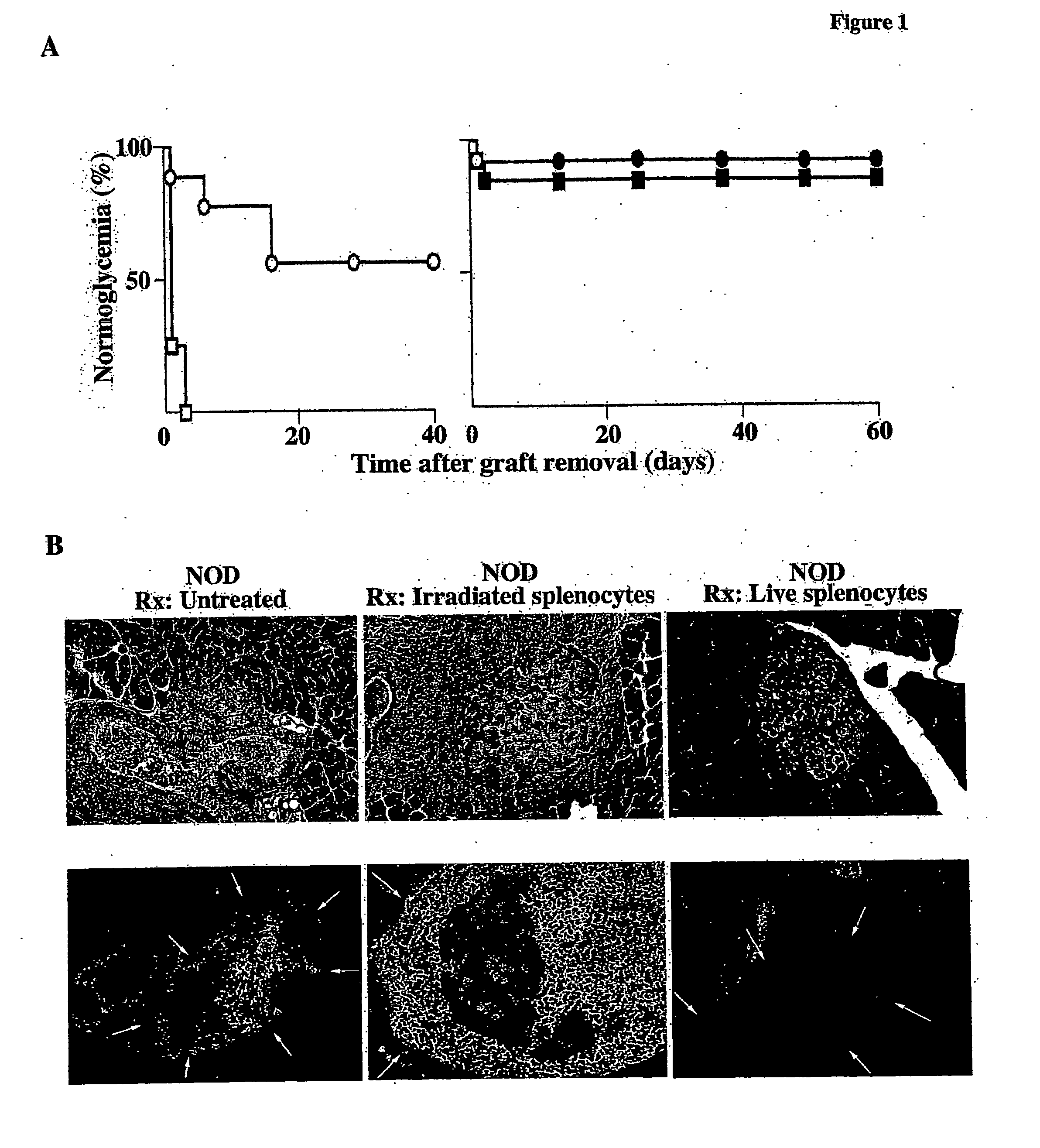 Methods of organ regeneration